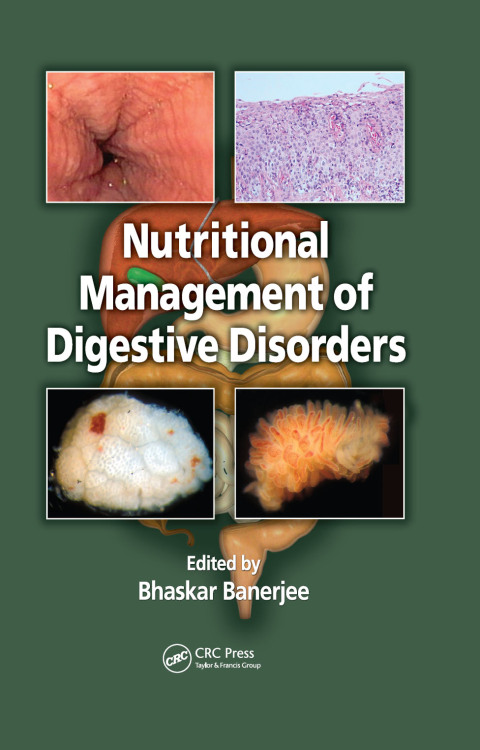 Nutritional Management of Digestive Disorders, 1st Edition - FULL INSTANT DOWNLOAD | PDF DOCX EPUB