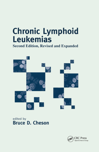 Imagen de portada: Chronic Lymphoid Leukemias 2nd edition 9780824705435