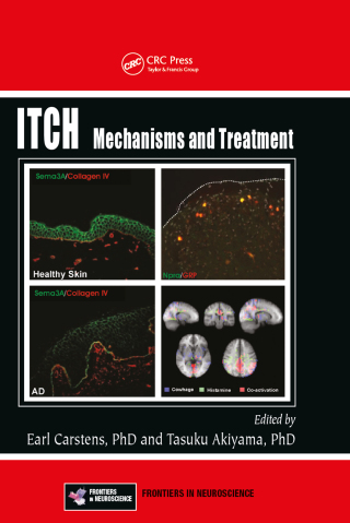 Imagen de portada: Itch 1st edition 9781466505438