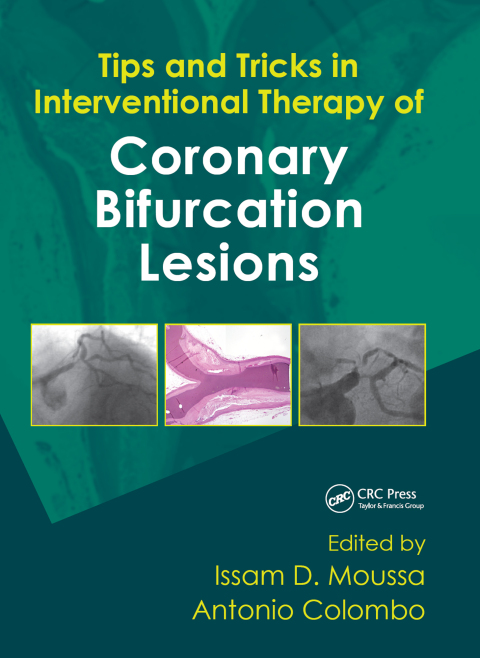 Tips and Tricks in Interventional Therapy of Coronary Bifurcation Lesions, 1st Edition - FULL INSTANT DOWNLOAD | PDF DOCX EPUB