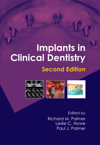 Cover image: Implants in Clinical Dentistry 2nd edition 9781841849065
