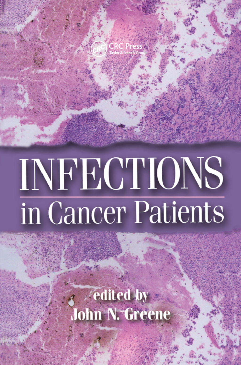 Infections in Cancer Patients 1st Edition