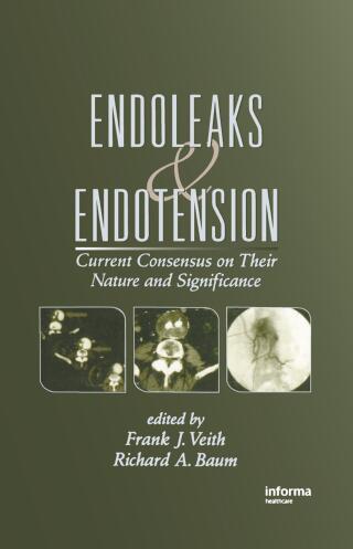 Cover image: Endoleaks and Endotension 1st edition 9780824709549