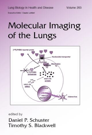 Cover image: Molecular Imaging of the Lungs 1st edition 9780367392819