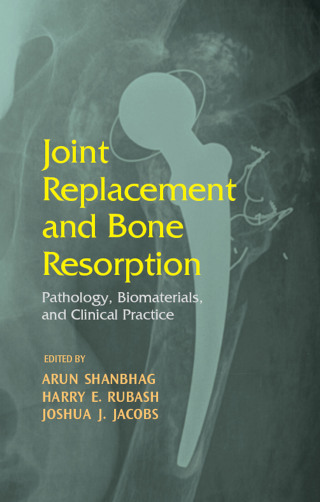 Cover image: Joint Replacement and Bone Resorption 1st edition 9780367391805