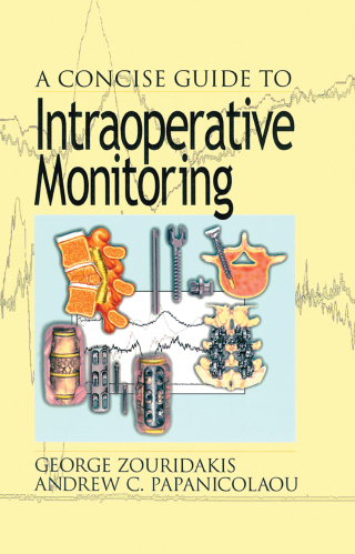 Immagine di copertina: A Concise Guide to Intraoperative Monitoring 1st edition 9780849308864