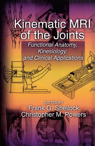 Immagine di copertina: Kinematic MRI of the Joints 1st edition 9780367397463
