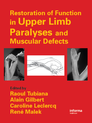 صورة الغلاف: Restoration of Function in Upper Limb Paralyses and Muscular Defects 1st edition 9781841843810