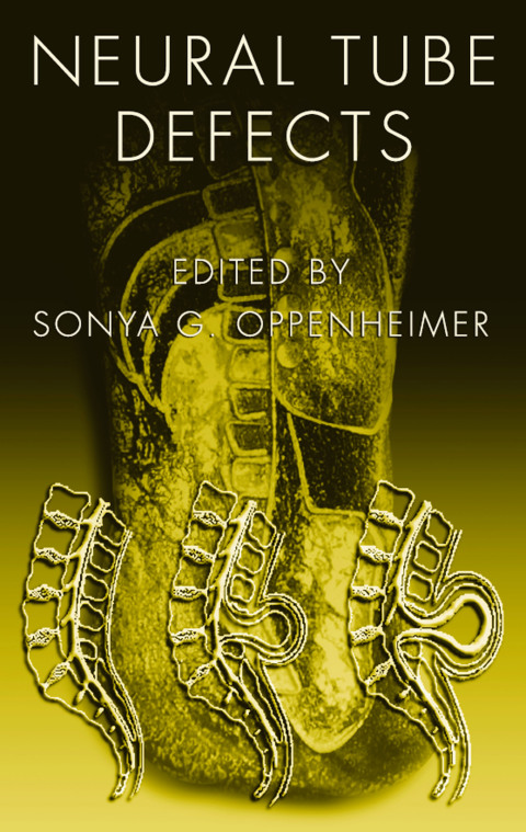 Neural Tube Defects, 1st Edition - FULL INSTANT DOWNLOAD | PDF DOCX EPUB