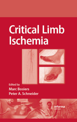 Cover image: Critical Limb Ischemia 1st edition 9781420081893