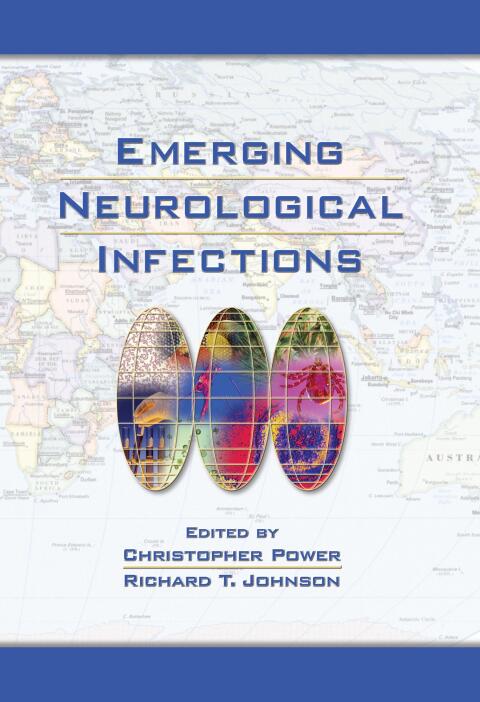 Emerging Neurological Infections, 1st Edition - FULL INSTANT DOWNLOAD | PDF DOCX EPUB