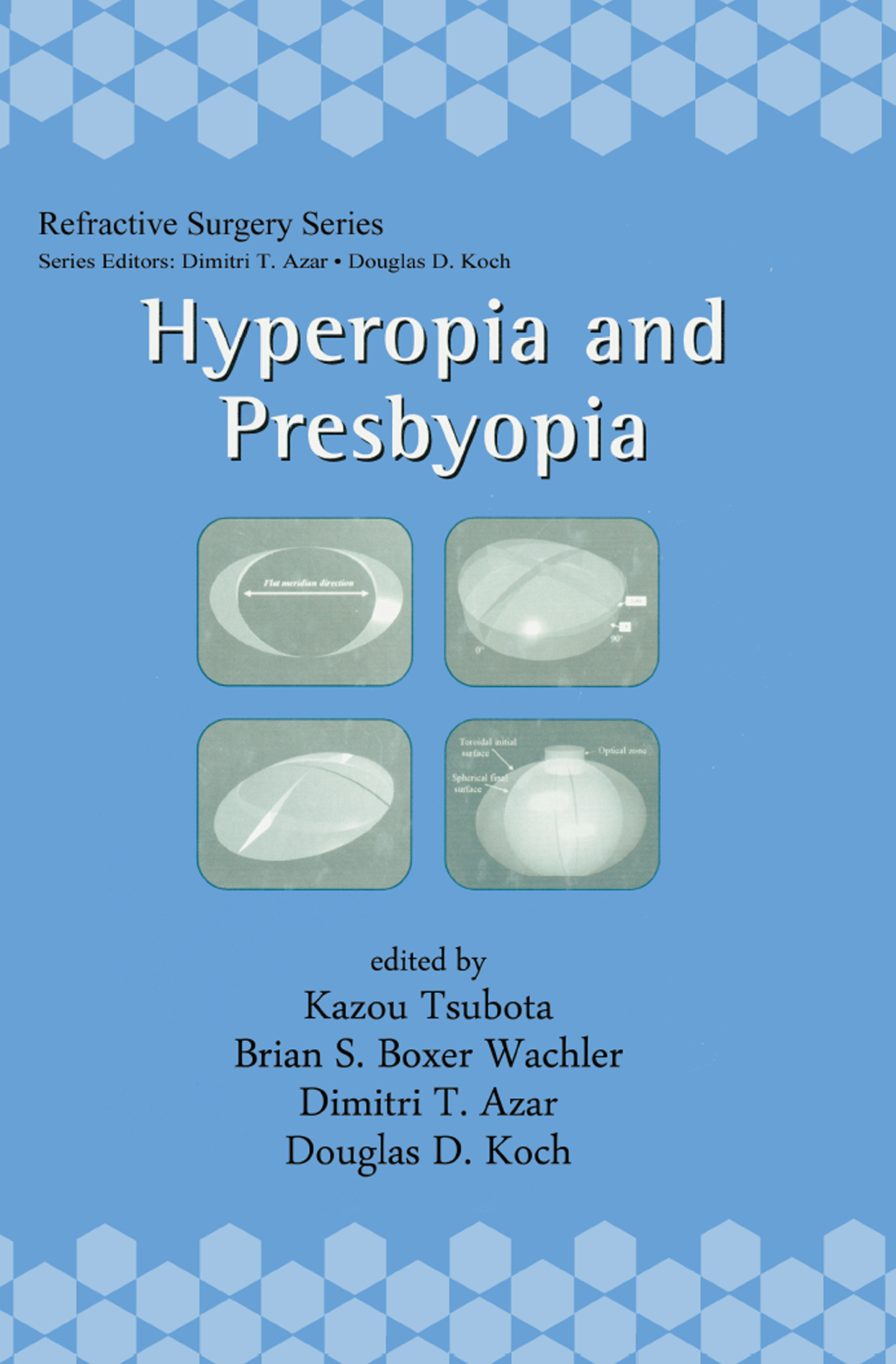Hyperopia and Presbyopia 1st Edition