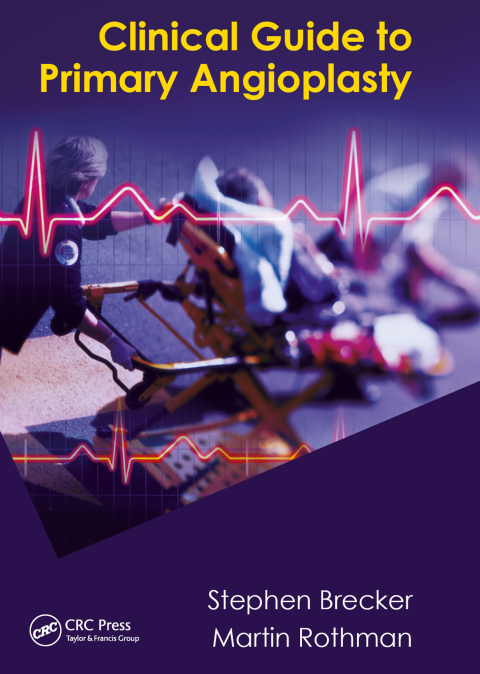 Clinical Guide to Primary Angioplasty, 1st Edition - FULL INSTANT DOWNLOAD | PDF DOCX EPUB