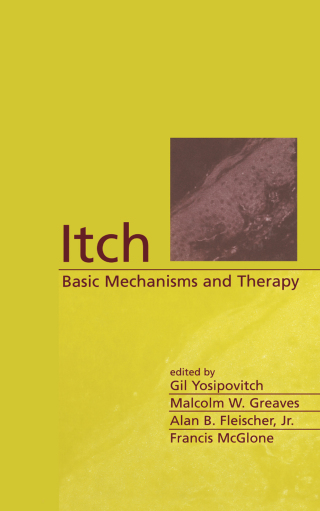 Cover image: Itch 1st edition 9780824747473