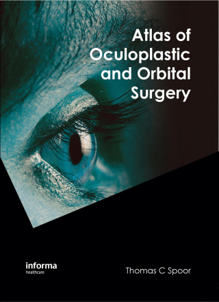 Cover image: Atlas of Oculoplastic and Orbital Surgery 1st edition 9781841845869