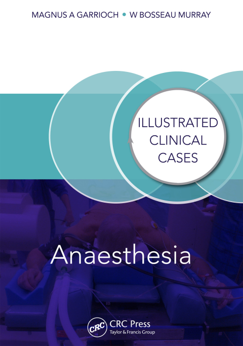 Anaesthesia: Illustrated Clinical Cases, 1st Edition - FULL INSTANT DOWNLOAD | PDF DOCX EPUB
