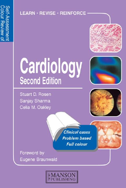 Cardiology: Self-Assessment Colour Review, Second Edition, 2nd Edition - FULL INSTANT DOWNLOAD | PDF DOCX EPUB