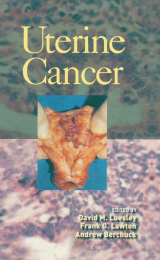 Cover image: Uterine Cancer 1st edition 9780824759513
