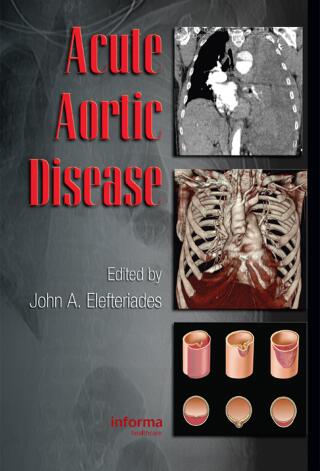 Imagen de portada: Acute Aortic Disease 1st edition 9780849370236
