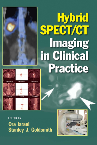 Cover image: Hybrid SPECT/CT Imaging in Clinical Practice 1st edition 9780824728540