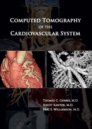 Cover image: Computed Tomography of the Cardiovascular System 1st edition 9780367387839