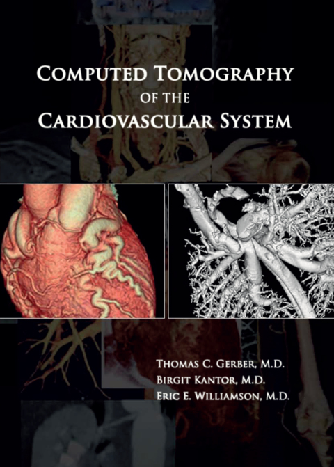 Computed Tomography of the Cardiovascular System, 1st Edition - FULL INSTANT DOWNLOAD | PDF DOCX EPUB