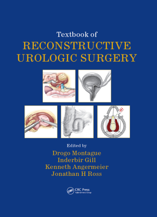 Cover image: Textbook of Reconstructive Urologic Surgery 1st edition 9781841846446