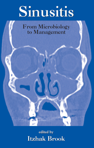 Imagen de portada: Sinusitis 1st edition 9780367392154