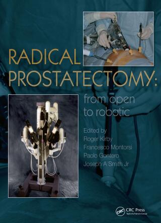 Cover image: Radical Prostatectomy 1st edition 9781841846279