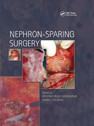 Imagen de portada: Nephron-Sparing Surgery 1st edition 9781841846361