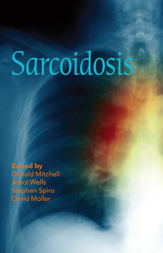 Cover image: Sarcoidosis 1st edition 9780367576769