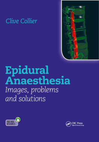 Cover image: Epidural Anaesthesia: Images, Problems and Solutions 1st edition 9781444156041