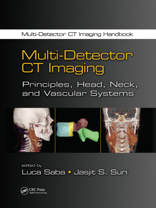 Imagen de portada: Multi-Detector CT Imaging 1st edition 9781439893807