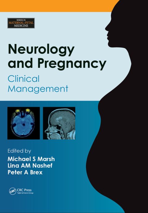 Neurology and Pregnancy: Clinical Management, 1st Edition - FULL INSTANT DOWNLOAD | PDF DOCX EPUB