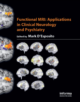 Imagen de portada: Functional MRI 1st edition 9781842142950