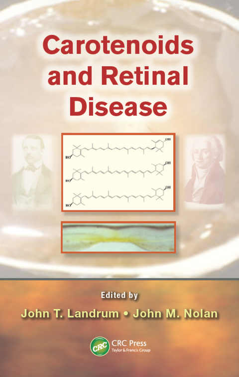 Carotenoids and Retinal Disease, 1st Edition - FULL INSTANT DOWNLOAD | PDF DOCX EPUB