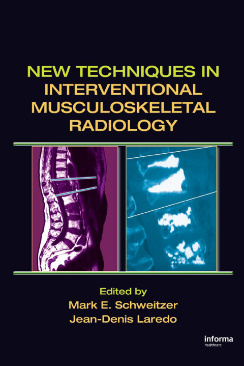 New Techniques in Interventional Musculoskeletal Radiology, 1st Edition - FULL INSTANT DOWNLOAD | PDF DOCX EPUB