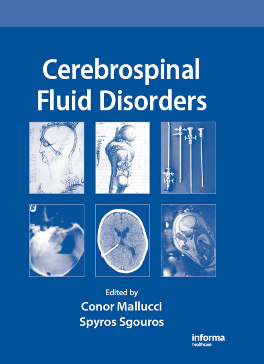 Cerebrospinal Fluid Disorders 1st Edition