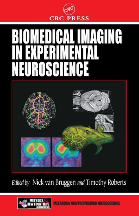 Biomedical Imaging in Experimental Neuroscience, 1st Edition - FULL INSTANT DOWNLOAD | PDF DOCX EPUB