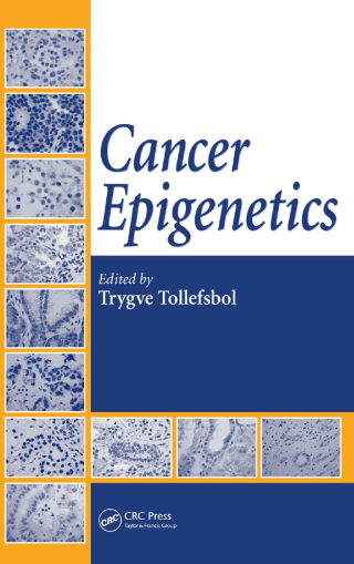 Cover image: Cancer Epigenetics 1st edition 9780367386863
