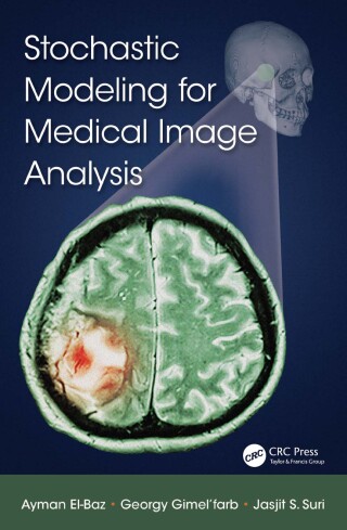 Omslagafbeelding: Stochastic Modeling for Medical Image Analysis 1st edition 9781032237541