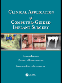 Imagen de portada: Clinical Application of Computer-Guided Implant Surgery 1st edition 9781482205411