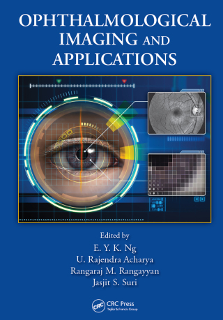 表紙画像: Ophthalmological Imaging and Applications 1st edition 9781466559134