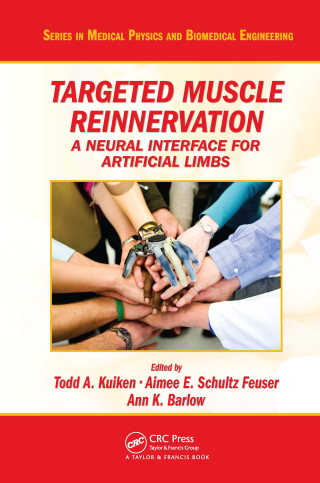 Cover image: Targeted Muscle Reinnervation 1st edition 9781439860809