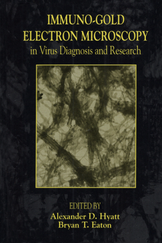 Cover image: Immuno-Gold Electron Microscopy in Virus Diagnosis and Research 1st edition 9780849367595