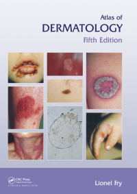 Cover image: Atlas of Dermatology, Fifth Edition 5th edition 9781841845227