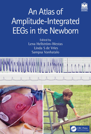 Cover image: An Atlas of Amplitude-Integrated EEGs in the Newborn 3rd edition 9781032258508