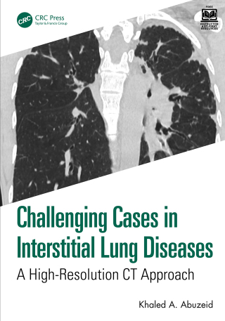 Cover image: Challenging Cases in Interstitial Lung Diseases 1st edition 9781032950051