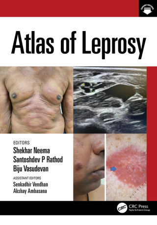Cover image: Atlas of Leprosy 1st edition 9781032209241