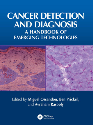 Cover image: Cancer Detection and Diagnosis 1st edition 9781032577012